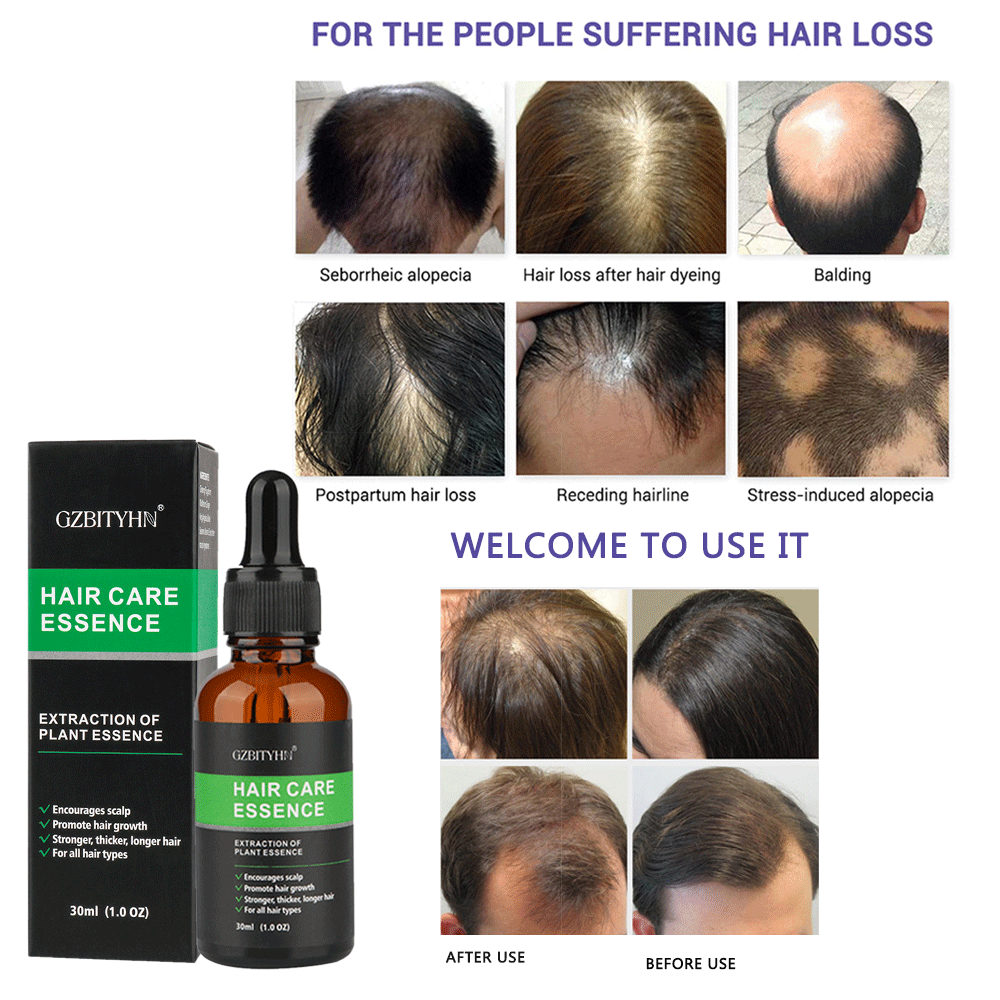 💧 SÉRUM D'HUILE POUR LA CROISSANCE DES CHEVEUX 💧