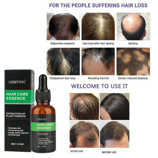 💧 SÉRUM D'HUILE POUR LA CROISSANCE DES CHEVEUX 💧