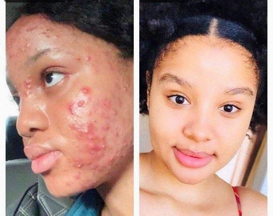 MASQUE FACIAL AU COLLAGENE