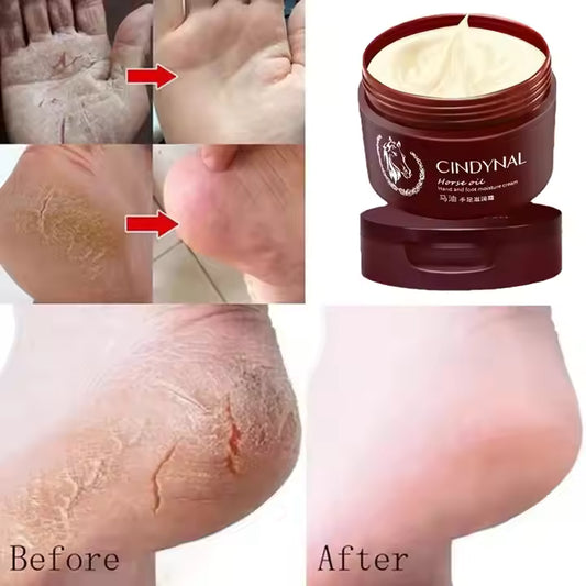 Crème pour les pieds réparatrice pour la peau morte